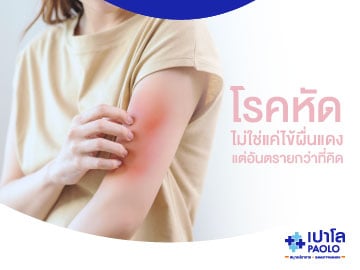 โรคหัด ไม่ใช่แค่ไข้ผื่นแดง แต่อันตรายกว่าที่คิด!